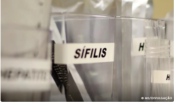 Centro de SP tem testagem grátis de HIV, hepatite, síflis e gonorreia